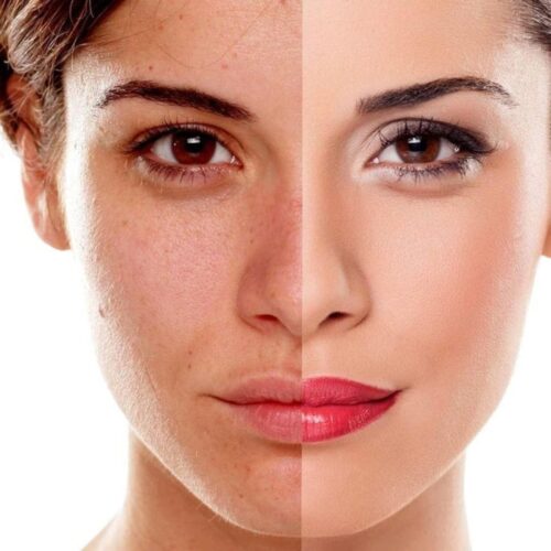 Untitled design (7) Pigmentation Facial(60 minutes)